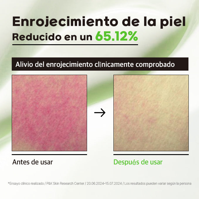 Crema Calmante tratamiento nocturno